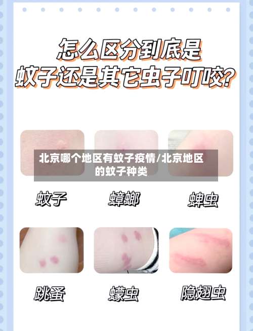 北京哪个地区有蚊子疫情/北京地区的蚊子种类-第2张图片